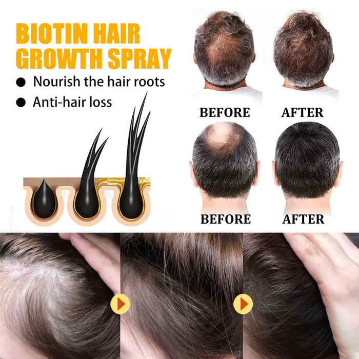 EELHOE Biotin Hair Growth Spray Strong Anti-Fall Hair Repair and Nourishing Hair Root Spray