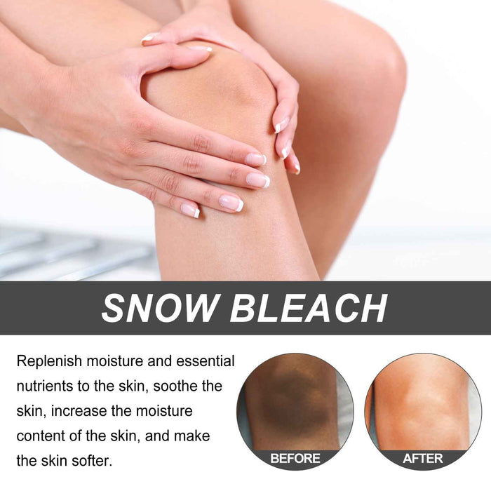 Underarm & Inner Thigh Dark Spot Corrector Cream - Niacinamide & Vitamin C Skin Brightening Cream
